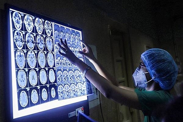 Black fungus India_1 